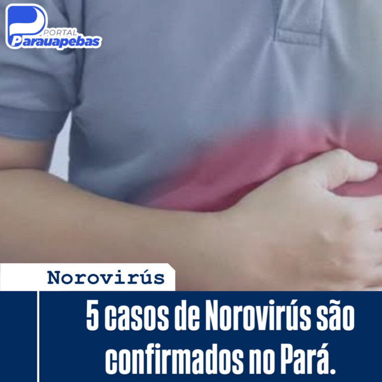 Norovirús