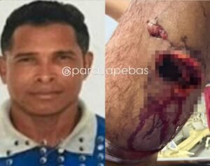 homem atacado por porco